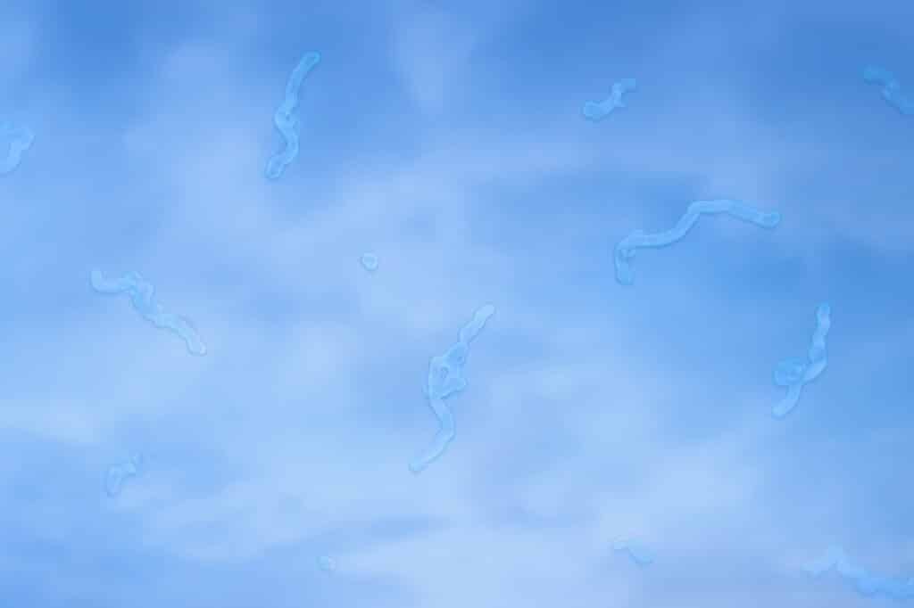 Flashes and Floaters